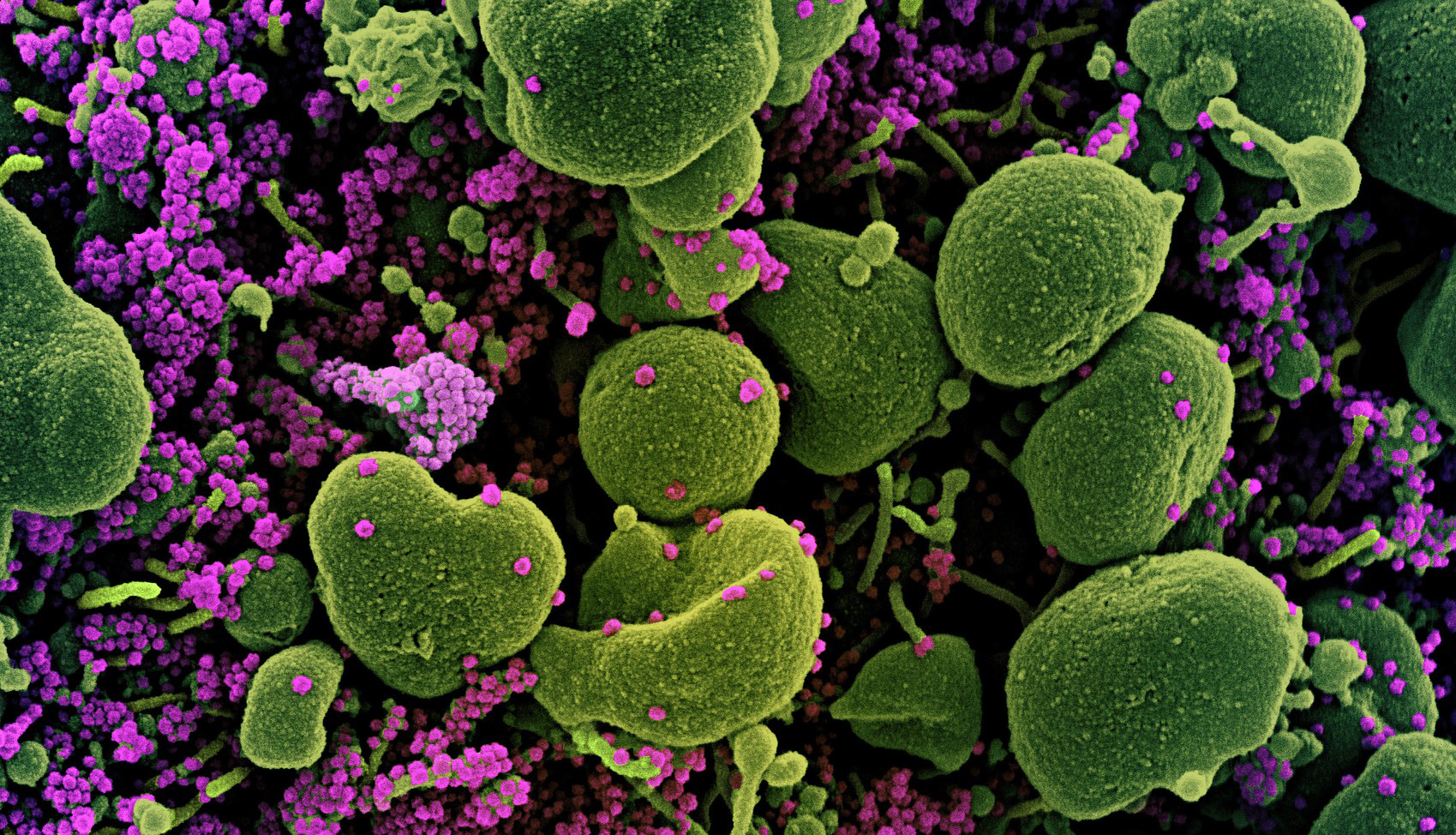 Relief for Air Hunger Harvard Medical School